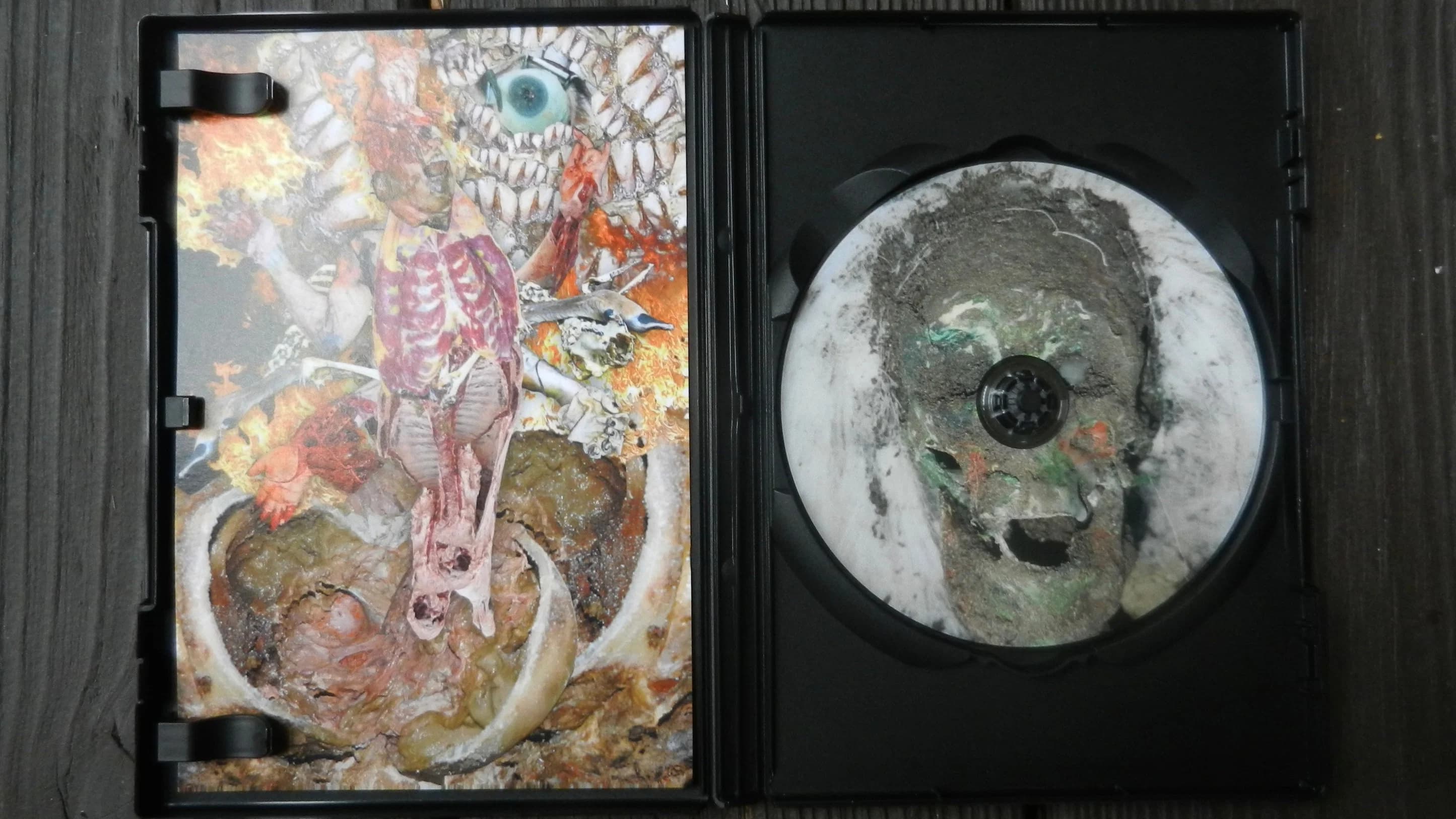 Corpse Syndrome