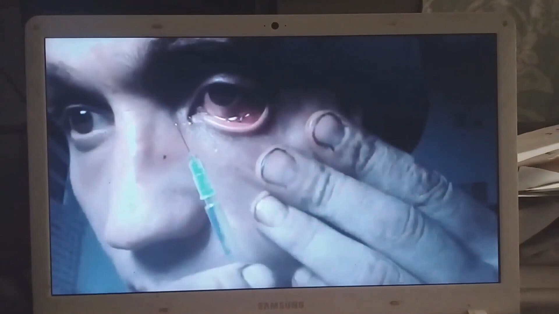 Cameras in the Eyes