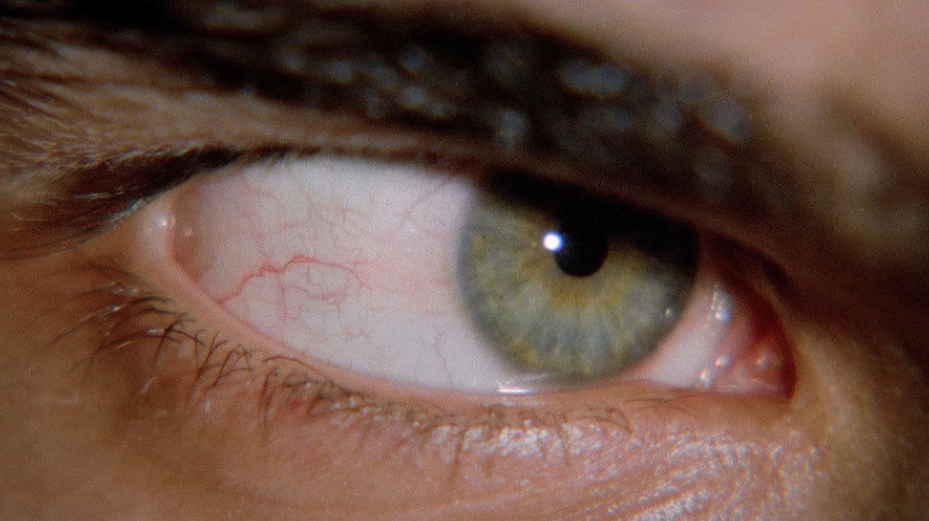 The Bloodstained Shadow