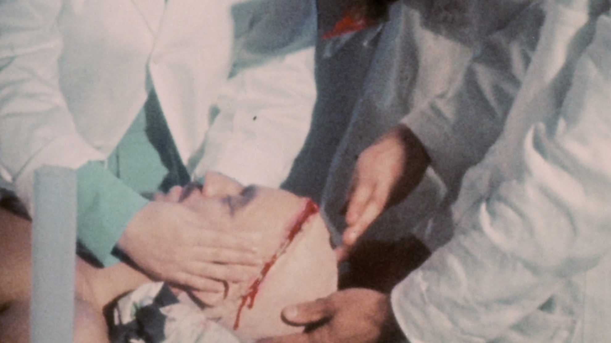 The Man with Two Heads